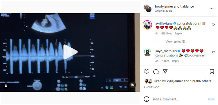 Comments on Brody Jenner's Post