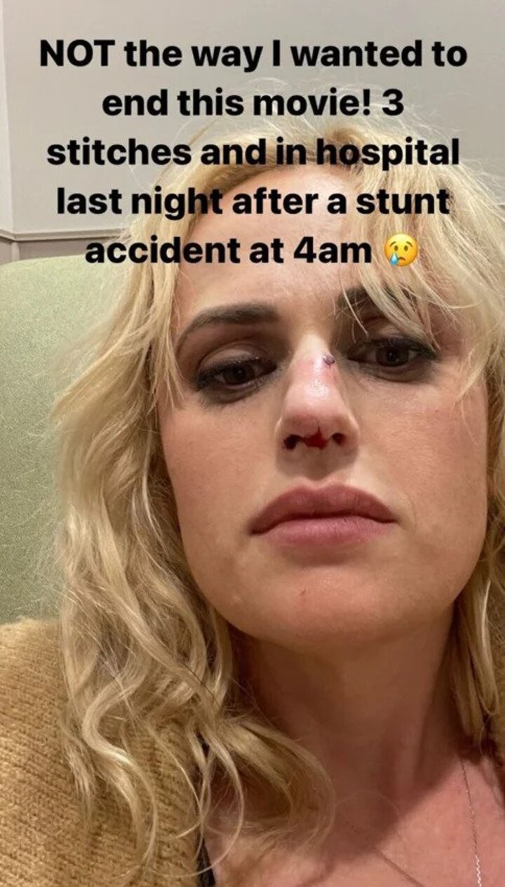 Rebel Wilson gets injured on set of 'Bride Hard'