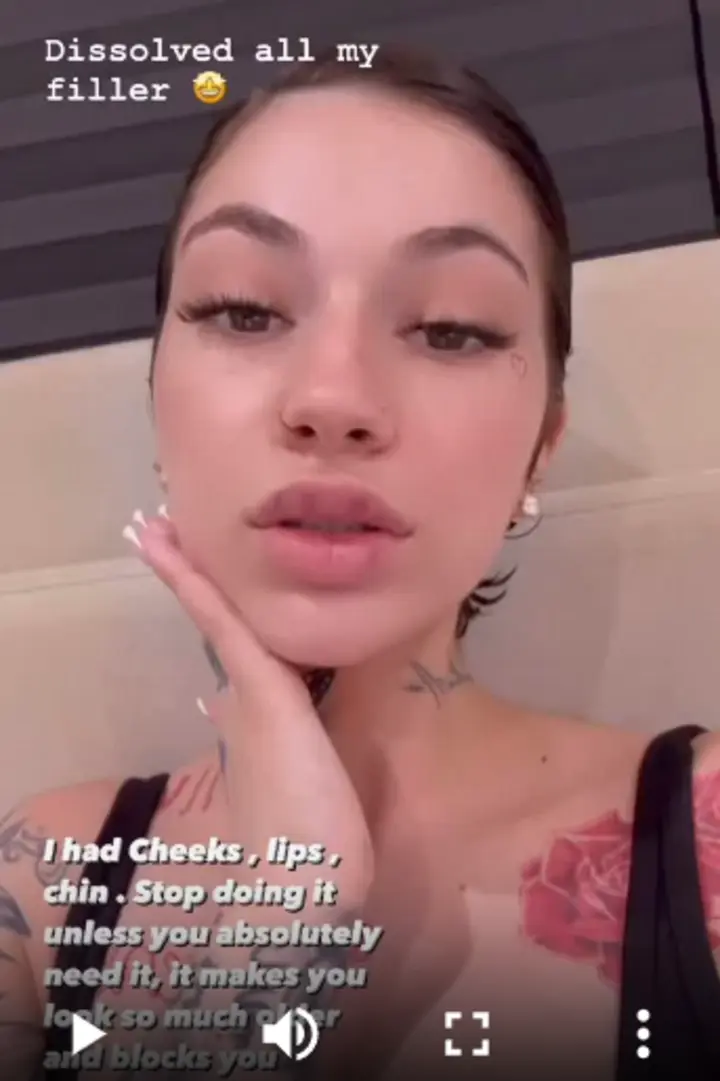 Bhad Bhabie is bare-faced after dissolving her face fillers