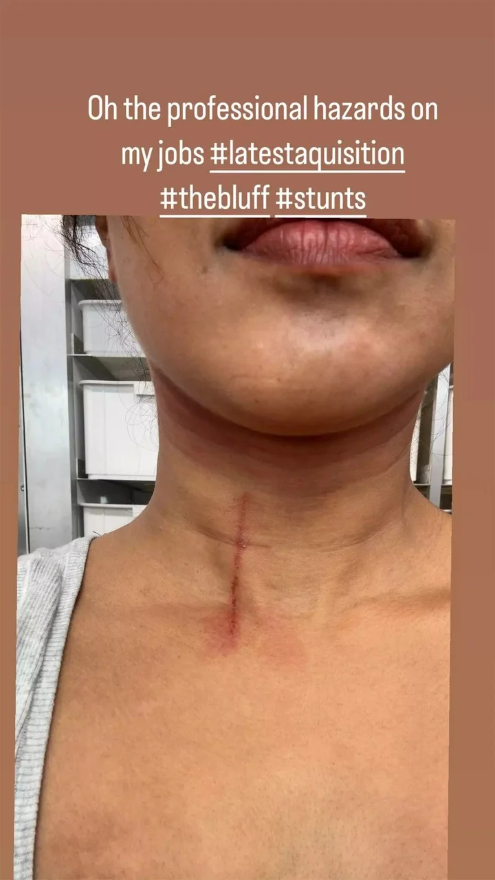 Priyanka Chopra gets injured on set of 'The Bluff'