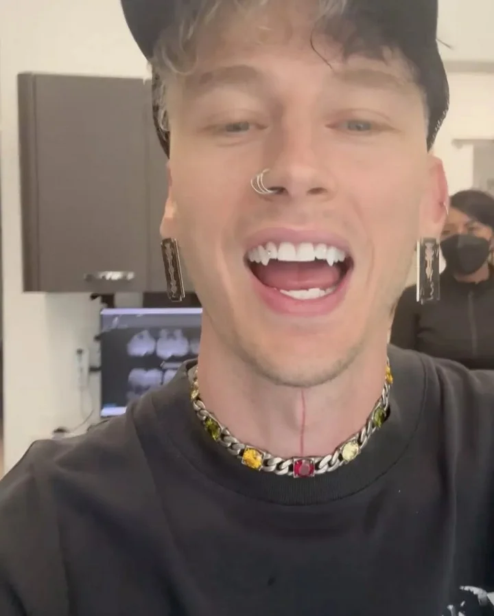 Machine Gun Kelly shows off his new fangs
