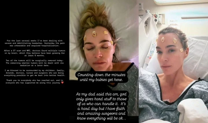 Teddi Mellencamp reveals battle with brain tumors