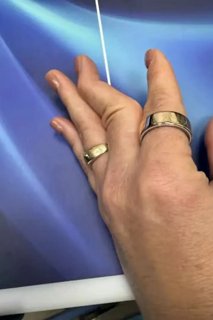 Jenna Bush Hager shows her injured finger