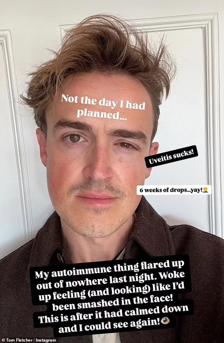 Tom Fletcher shows his face after flare-up