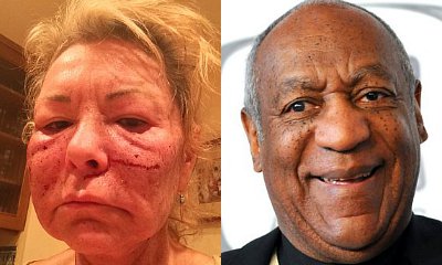Roseanne Barr Jokes About Getting Attacked by Bill Cosby