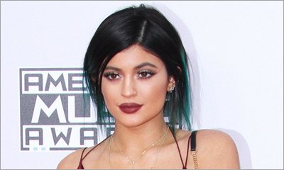 Kylie Jenner Admits: 'I Have Temporary Lip Fillers'