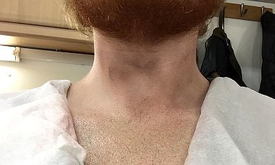 Ed Sheeran's Giant Lion Tattoo NOT Real