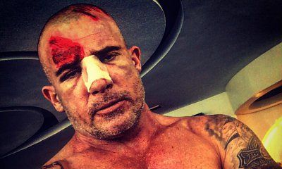 Dominic Purcell Seriously Injured on the Set of 'Prison Break'