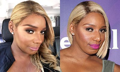 NeNe Leakes Sparks Nose Job Speculations in Latest Selfies