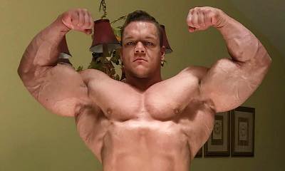 Bodybuilder Dallas McCarver Dies Possibly After Choking on Food