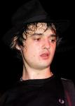 Pete Doherty Collapse Before Taking Austria's Gig Stage