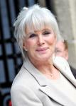 Linda Evans Did Surgery to Please Younger Lover