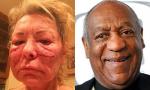 Roseanne Barr Jokes About Getting Attacked by Bill Cosby