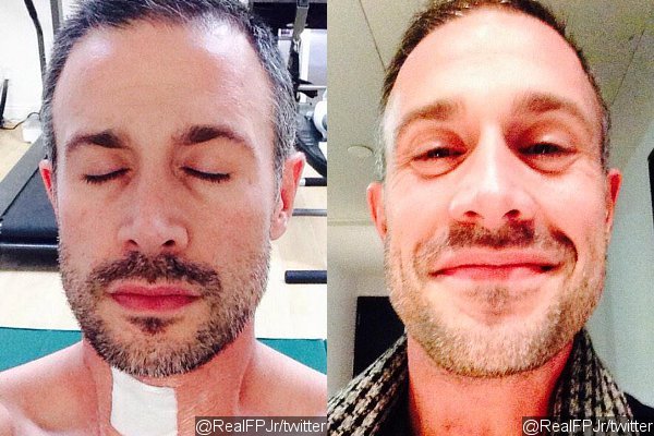Freddie Prinze Jr. Shares New Photo After Getting His Stitches Removed