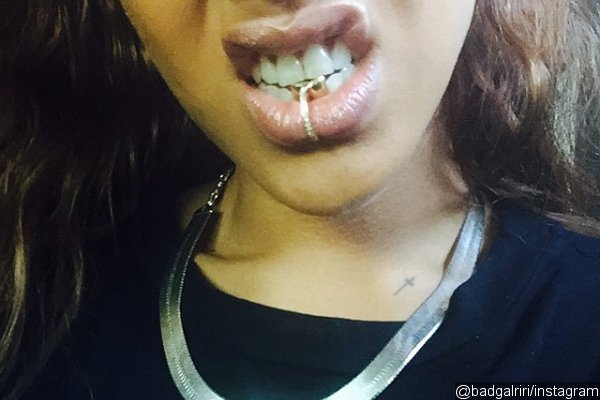 Rihanna Flashes Mouth Rings on Instagram Photos
