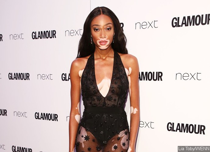 Winnie Harlow Proudly Flaunts Her 'Unique Beauty' as She Poses in Nothing But Nude Thong