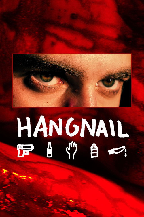 Hangnail