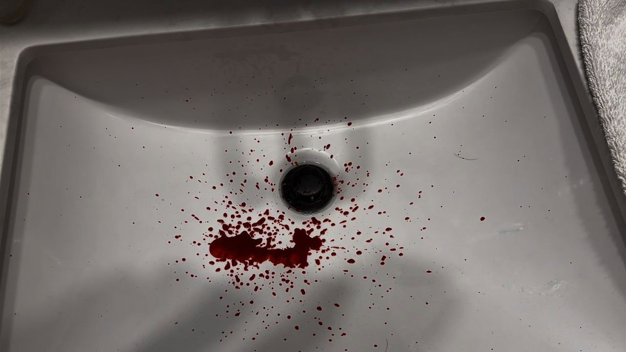Bloody Nose (2026)