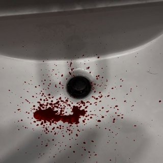 Bloody Nose (2026)