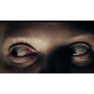 Clinical (2017)