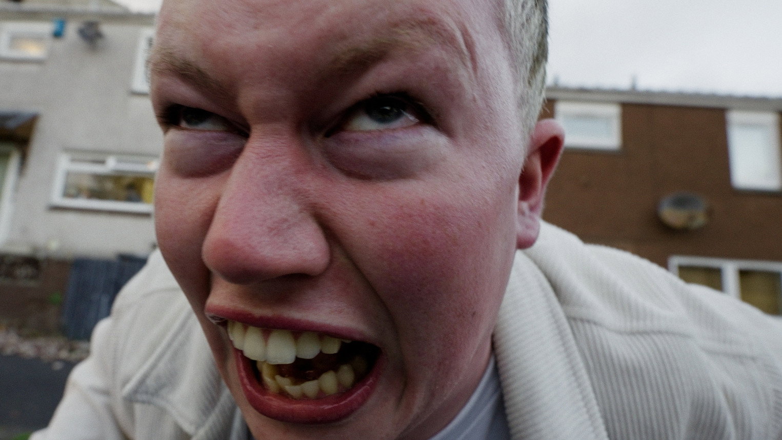 Thick Skin (2026)