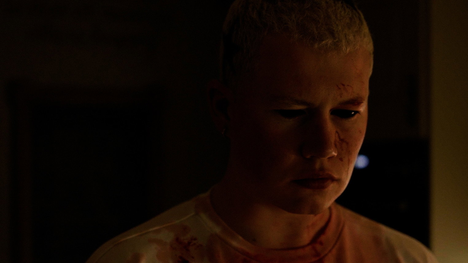 Thick Skin (2026)