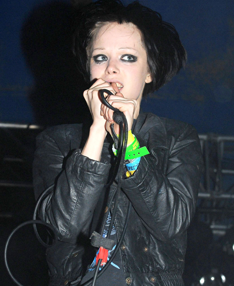 Alice Glass Hospitalized for Suspected Broken Ankle