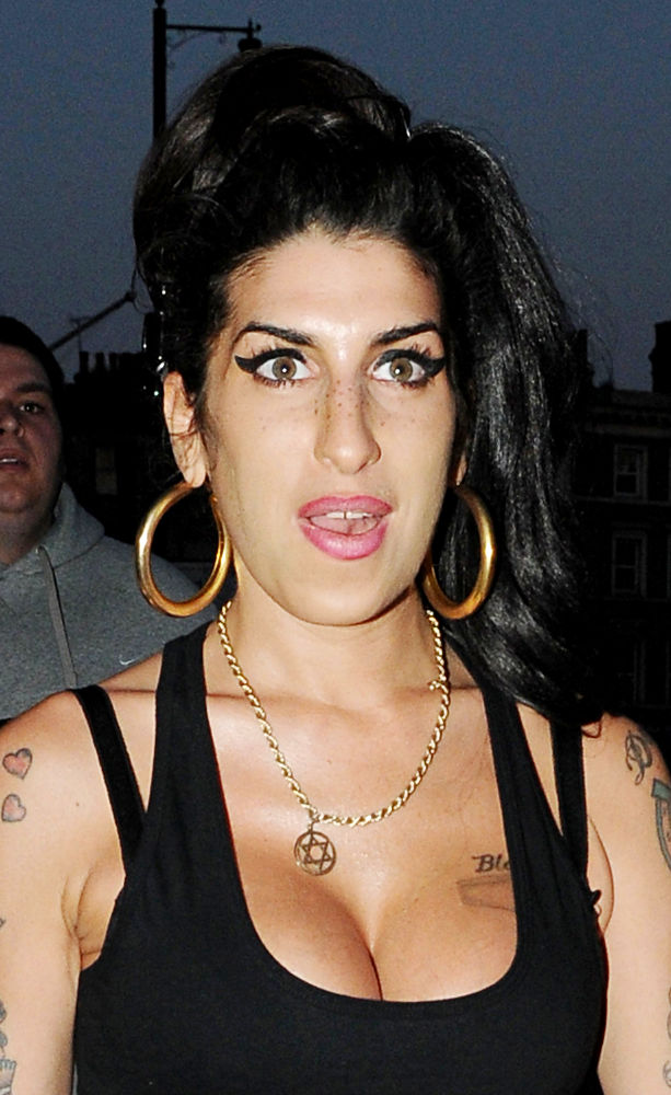 Amy Winehouse Hospitalized for Catching Virus