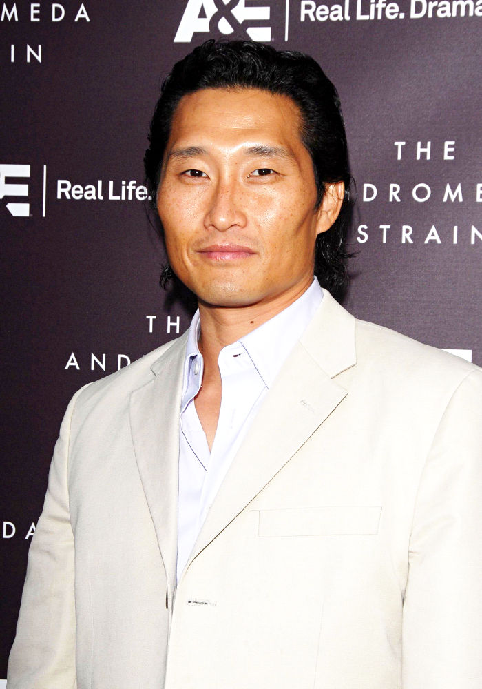 Daniel Dae Kim Had Wound in His Hand Glued Up During 'Lost' Shoot